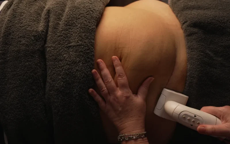 A person receives an ultrasound treatment on their abdomen while covered with a dark towel.